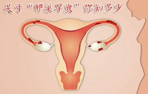 卵巢早衰_卵巢早衰怎么办_卵巢早衰的症状_卵巢早衰怎么治疗